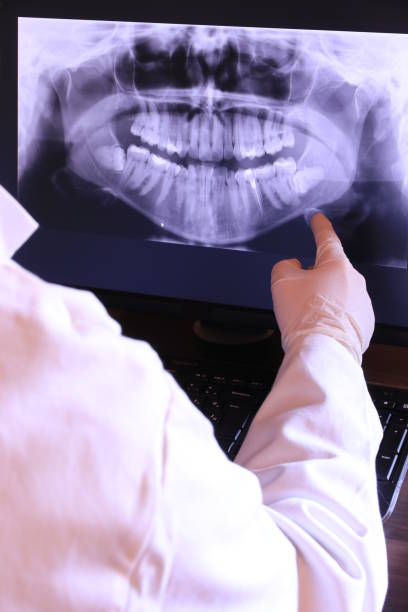 Best Emergency Root Canal Treatment in Greenbrier, TN